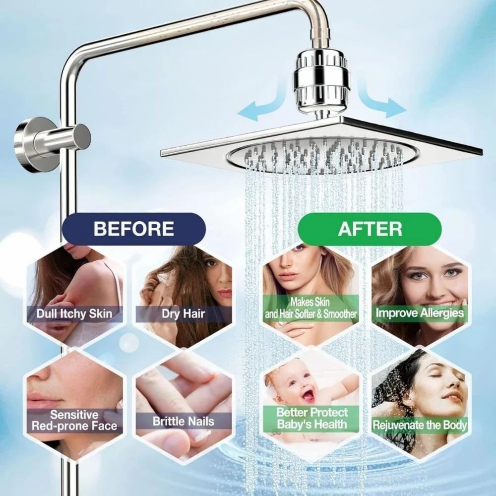 Hard-Water Shower Filter for Skin & Hair – Stops Hair Fall