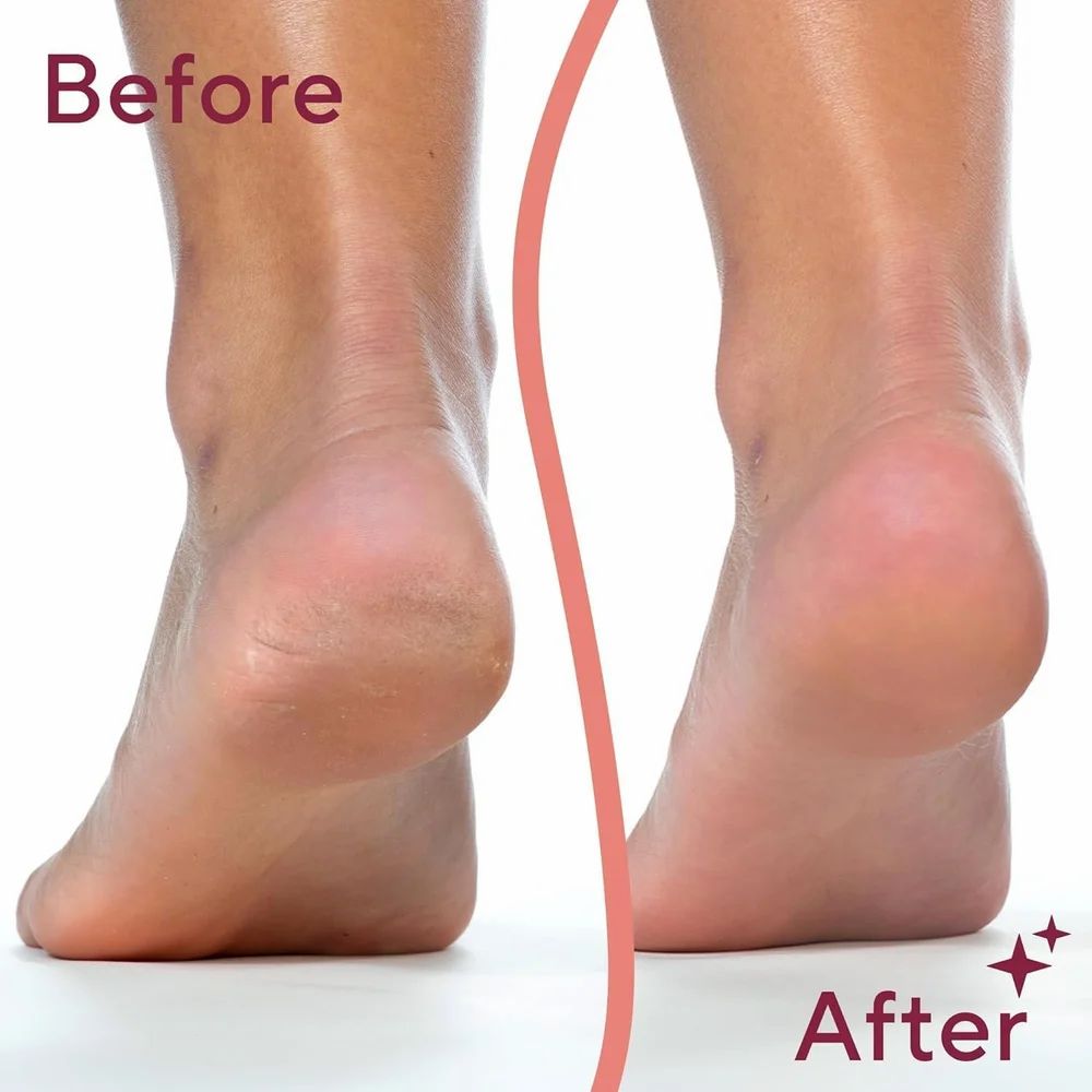 callus remover for feet dead skin remover pedicure tools Callus Remover Hard and Dead Skin Remover Electric Foot Callus Remover Rechargeable Pedicure Tool (Pink)
